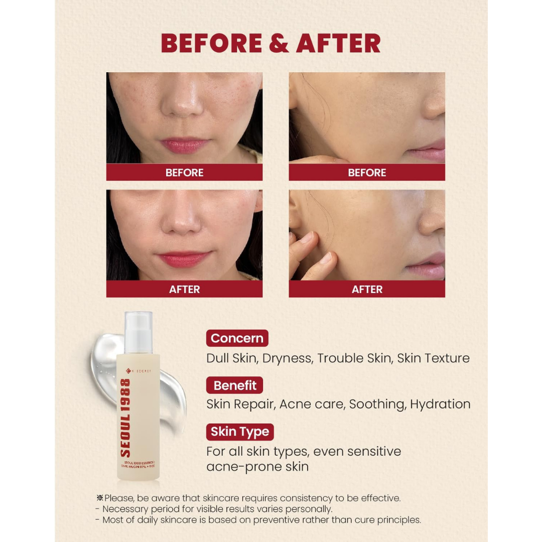 Seoul 1988 Essence : Snail Mucin 97% + Rice