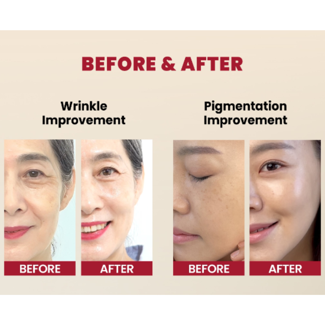 Seoul 1988 Serum : Retinal Liposome 2% + Black Ginseng