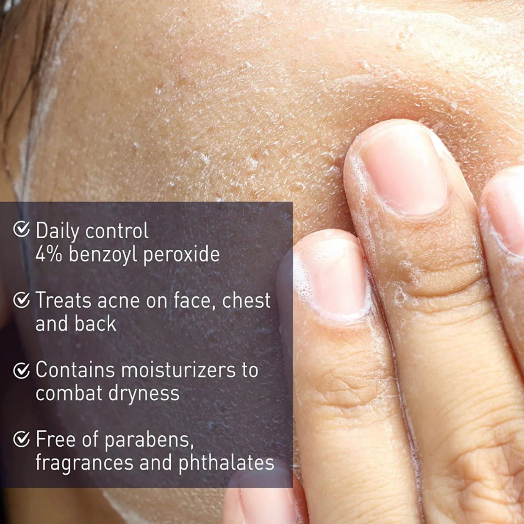Acne Creamy Wash 4% Benzoyl Peroxide