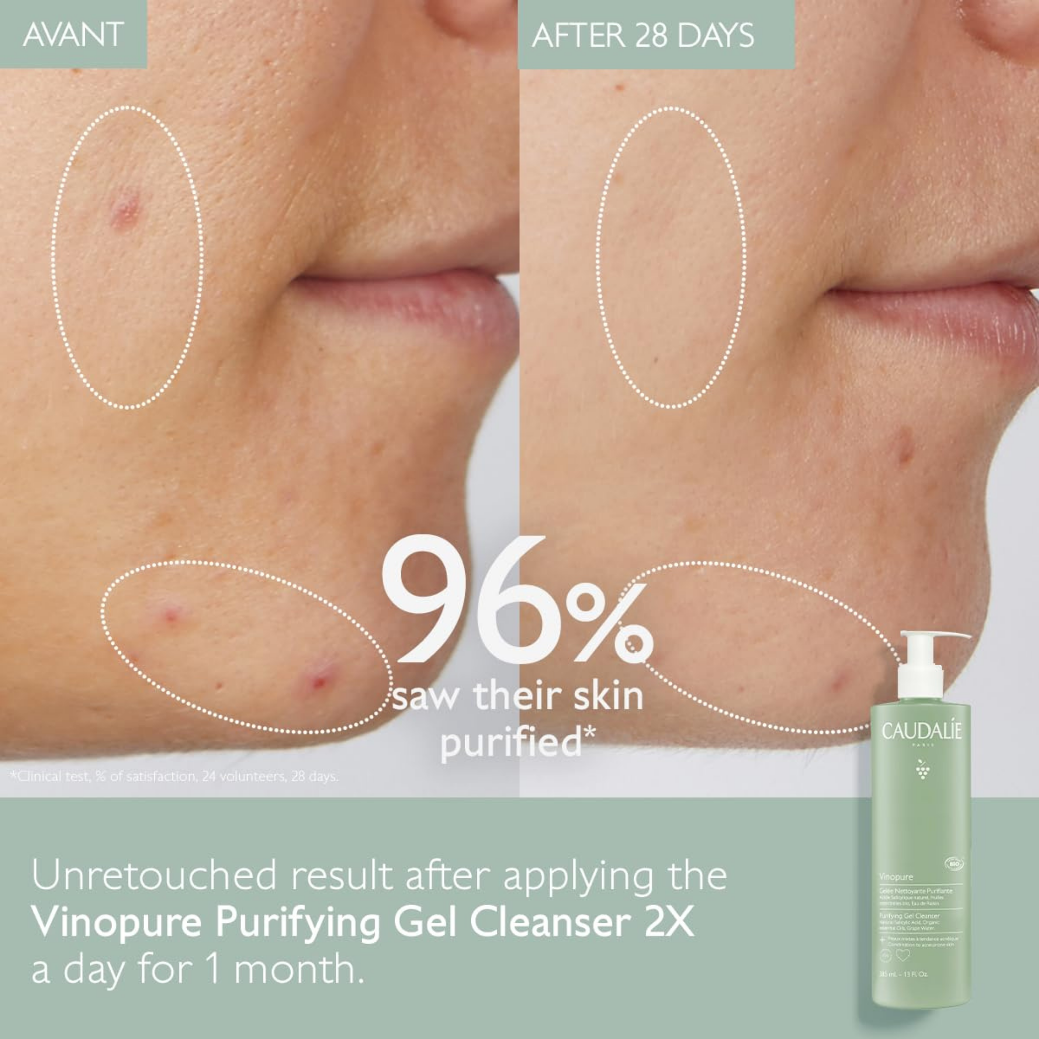 Gelée Nettoyante Purifiante Vinopure