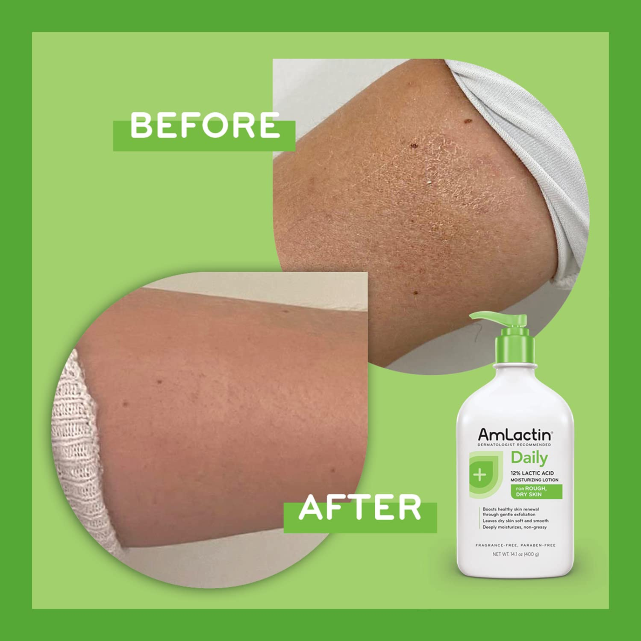 Daily Nourish 12% Lactic Acid