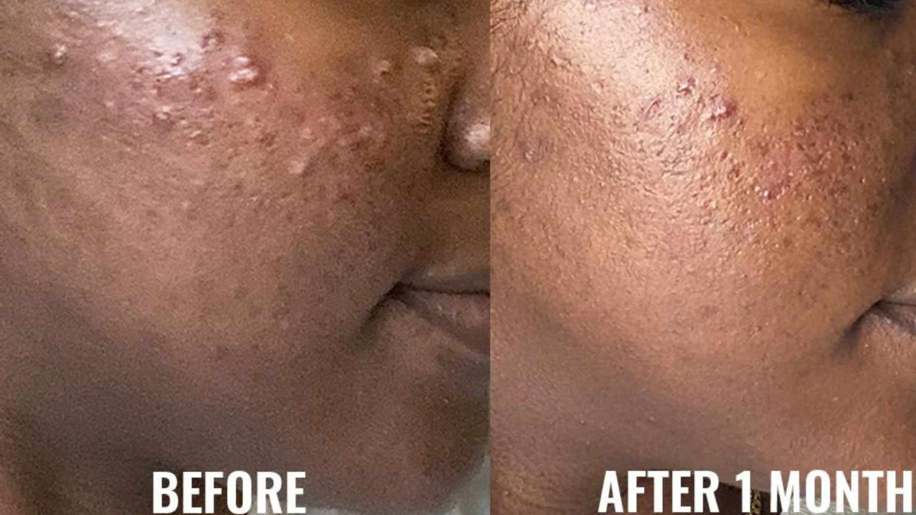 Discoloration Correcting Serum