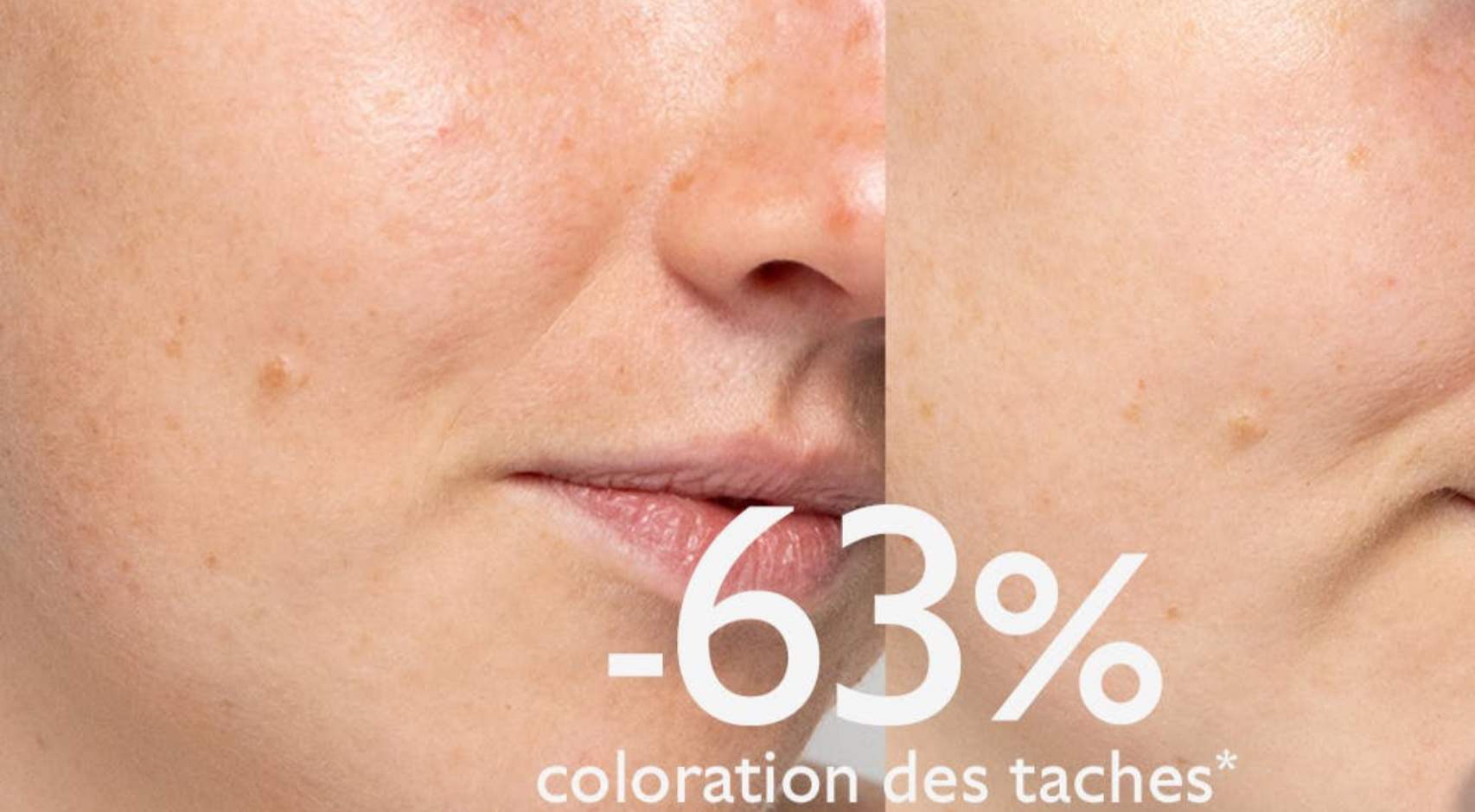 Sérum Éclat Anti-Taches Vinoperfect