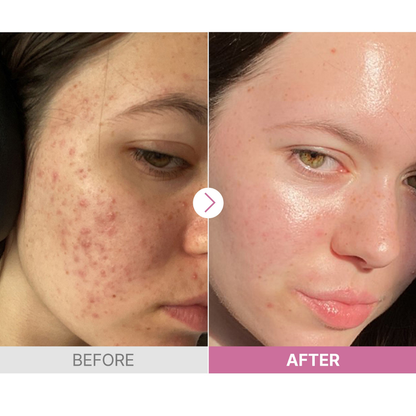 The Vitamin C 23 Serum