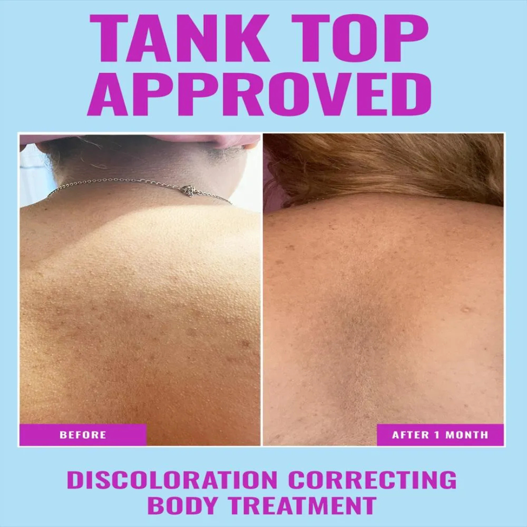 Discoloration Correcting Body Treatment