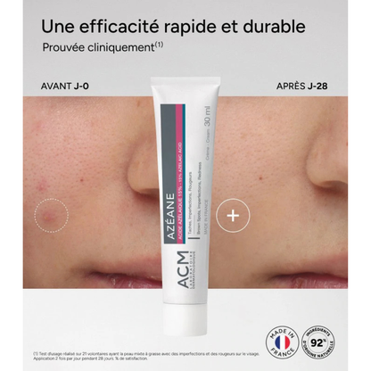 Azéane Crème 15% Acide Azélaique
