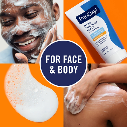 Acne Foaming Wash Benzoyl Peroxide 10% Maximum Strength