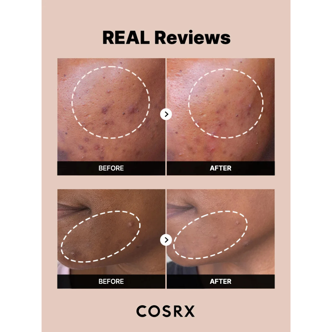 The Alpha-Arbutin 2 Discoloration Care Serum