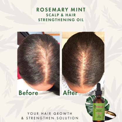 Rosemary Mint Scalp &amp; Hair Strengthening Oil