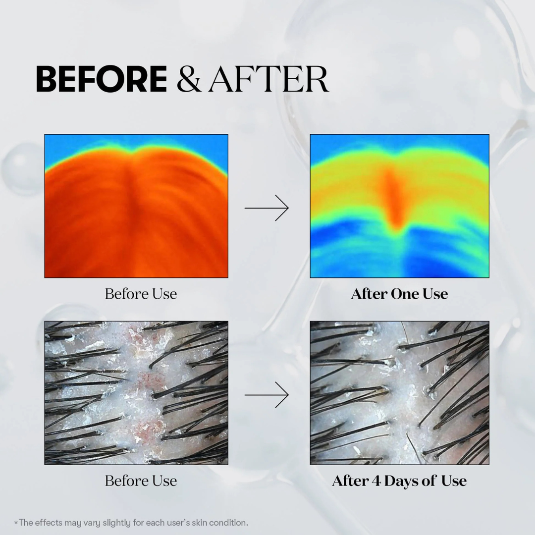 PDRN Reedle Shot Hair Ampoule 100DL